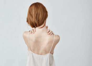 Reducing back fat with fat freezing: A solution for men and women